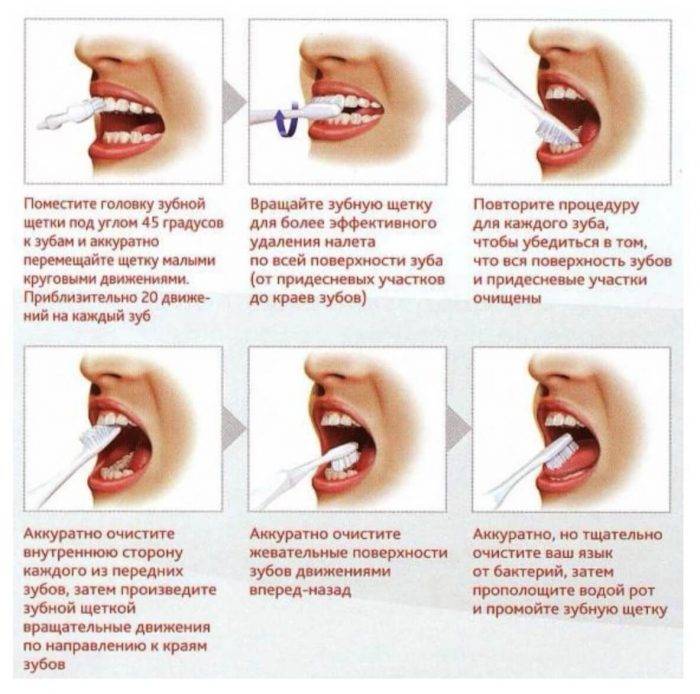 Методы гигиены и средства по уходу за полостью рта | listerine® (листерин®) 